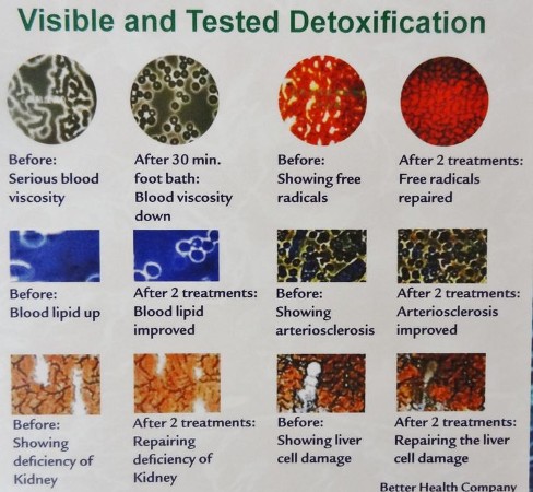 Detoxification Before and After