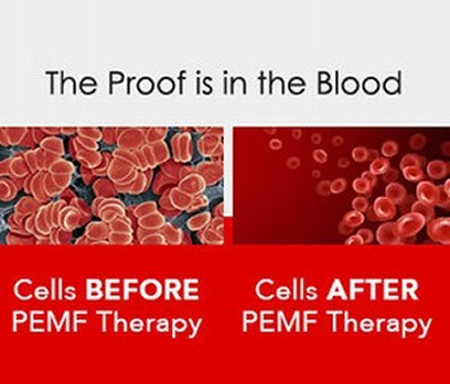 Blood Before and After