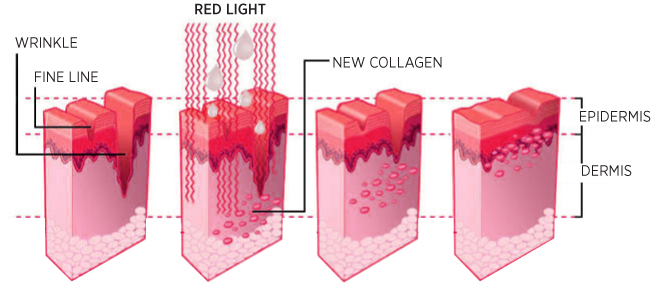 Collagen Graph Collagen Graph