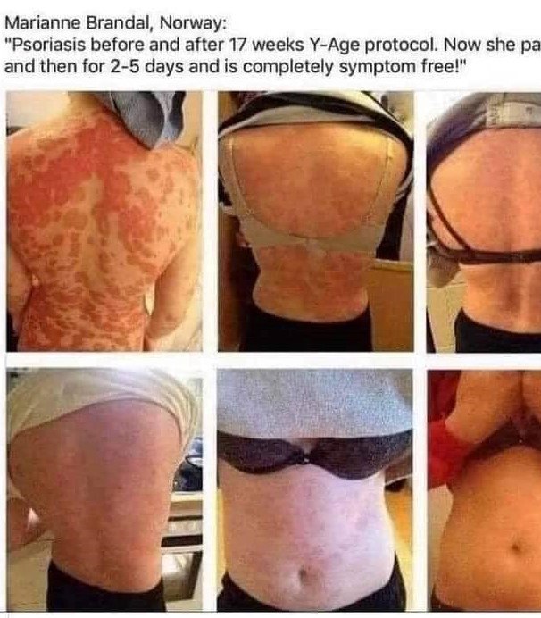 Auto-Immune Disorders
